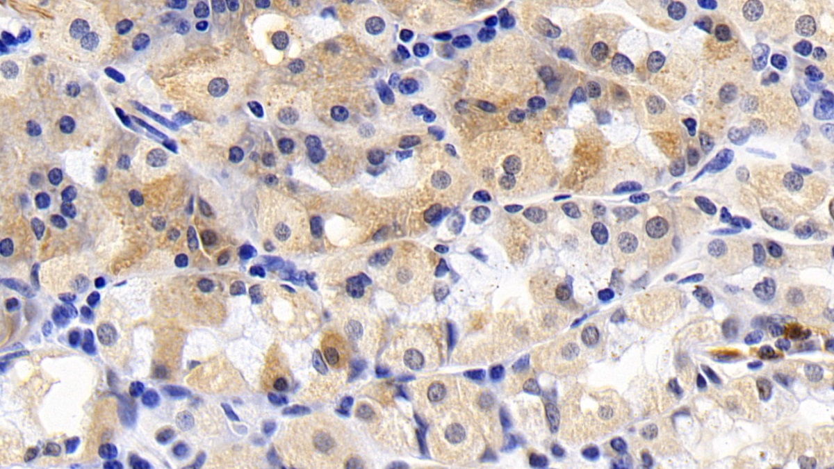 Monoclonal Antibody to B-Cell Leukemia/Lymphoma 2 (Bcl2)