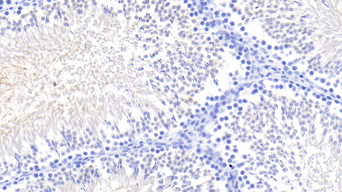 Monoclonal Antibody to Kidney Injury Molecule 1 (Kim1)