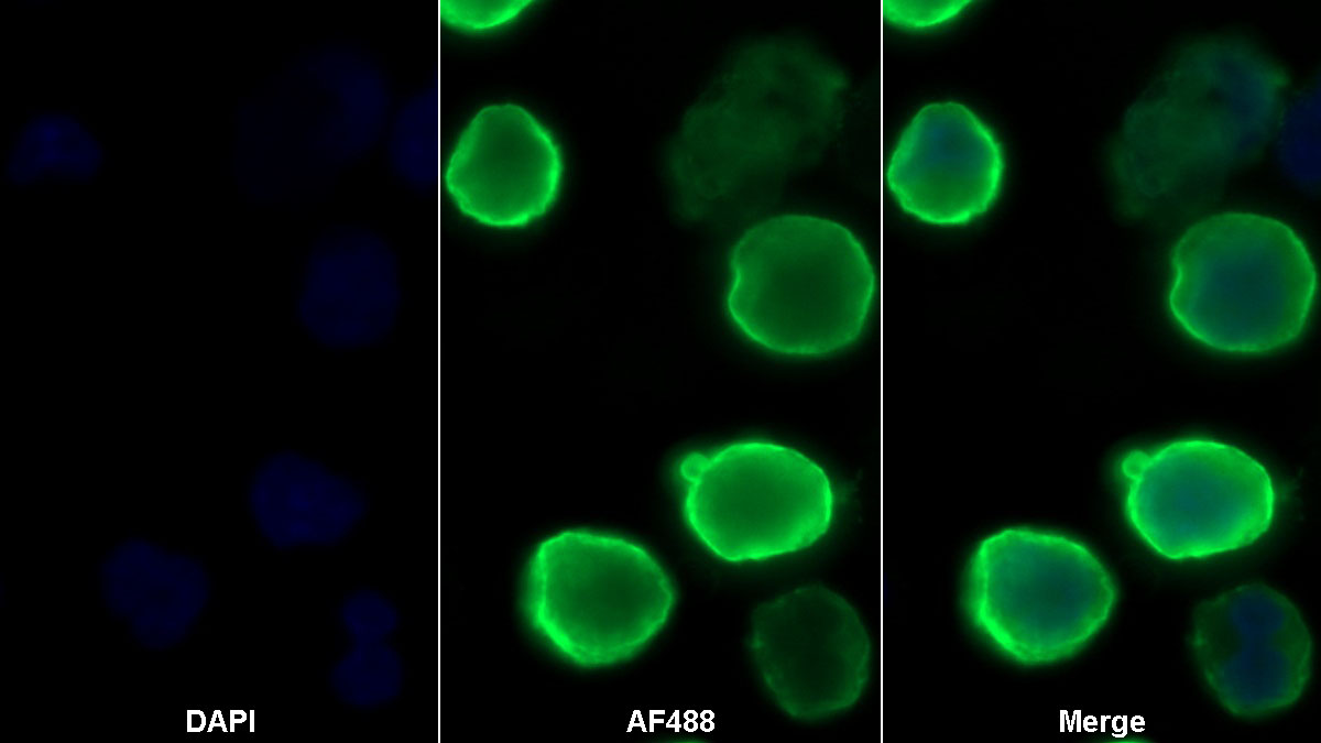 Monoclonal Antibody to Programmed Cell Death Protein 1 Ligand 1 (PDL1)