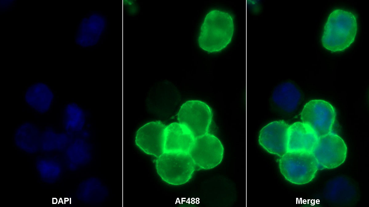 Monoclonal Antibody to Programmed Cell Death Protein 1 Ligand 1 (PDL1)