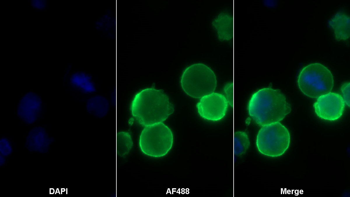 Monoclonal Antibody to Programmed Cell Death Protein 1 Ligand 1 (PDL1)