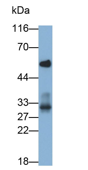 Monoclonal Antibody to Programmed Cell Death Protein 1 Ligand 1 (PDL1)