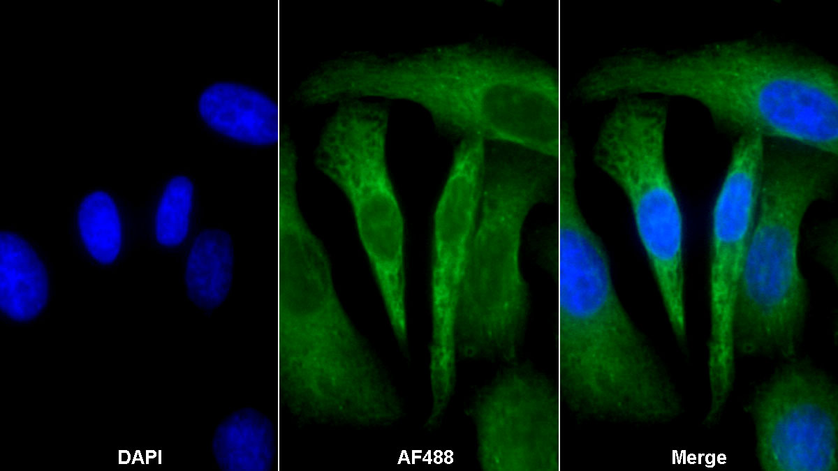 Monoclonal Antibody to Programmed Cell Death Protein 1 Ligand 1 (PDL1)