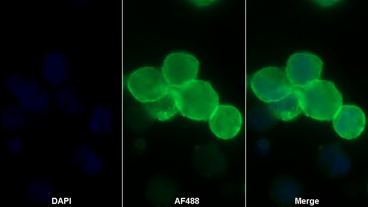 Monoclonal Antibody to Programmed Cell Death Protein 1 Ligand 1 (PDL1)