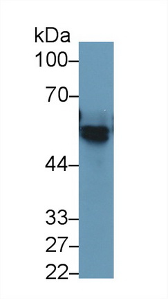 Monoclonal Antibody to Angiotensinogen (AGT)