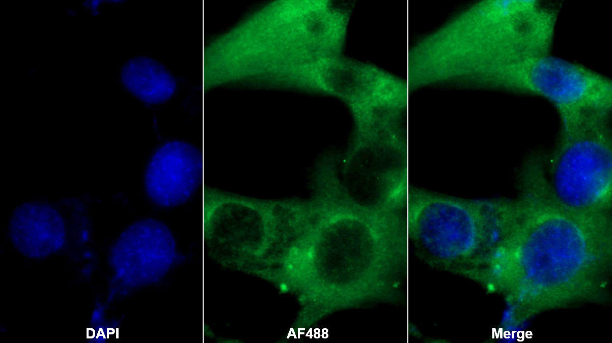 Monoclonal Antibody to Angiotensinogen (AGT)