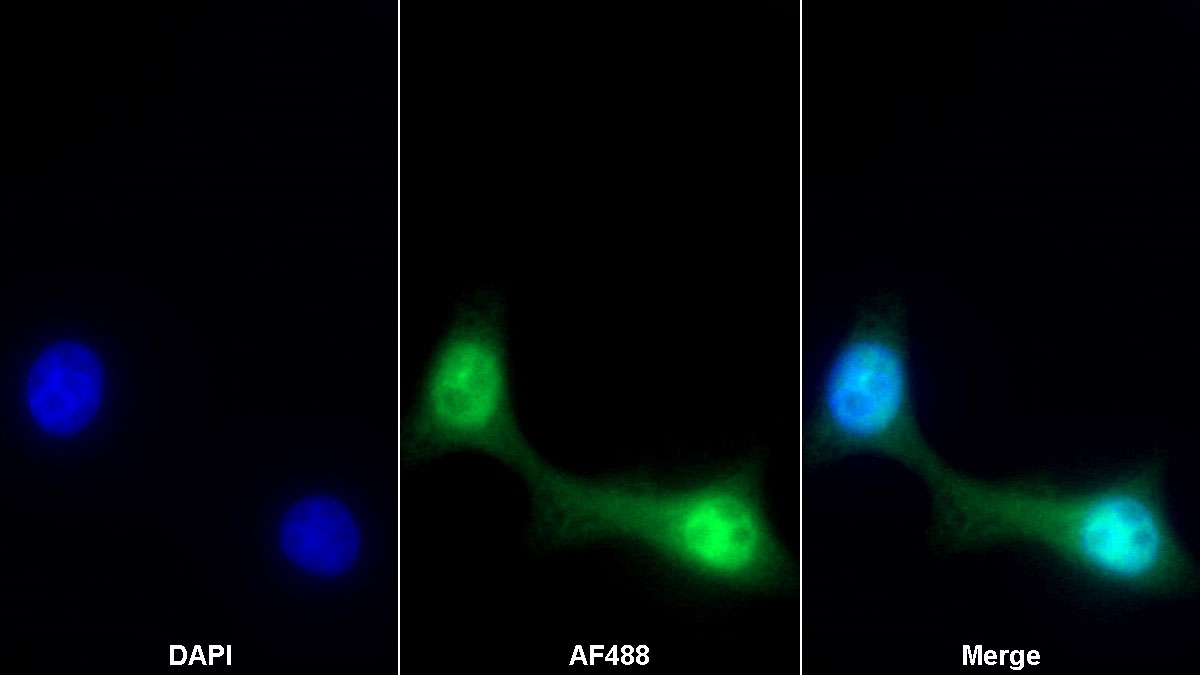 Monoclonal Antibody to Hypoxia Inducible Factor 1 Alpha (HIF1a)