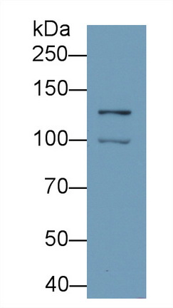 Monoclonal Antibody to Hypoxia Inducible Factor 1 Alpha (HIF1a)