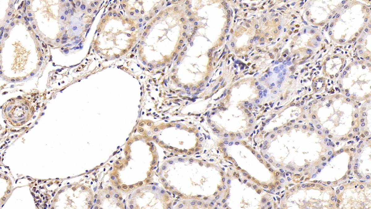 Monoclonal Antibody to Hypoxia Inducible Factor 1 Alpha (HIF1a)