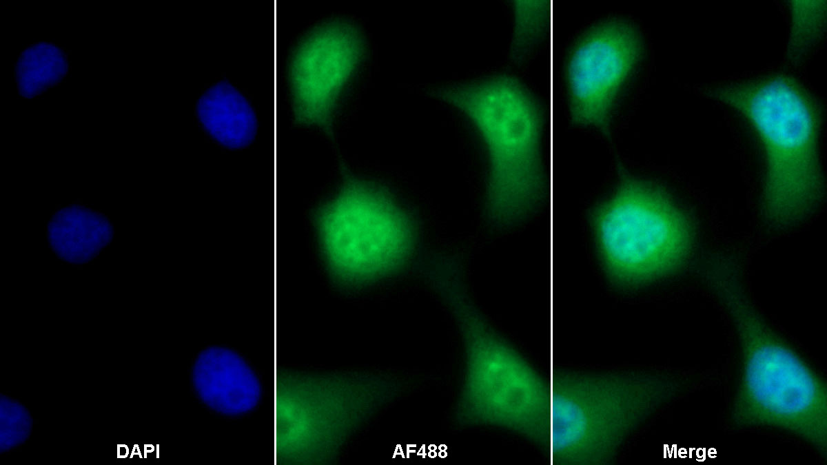 Monoclonal Antibody to Hypoxia Inducible Factor 1 Alpha (HIF1a)