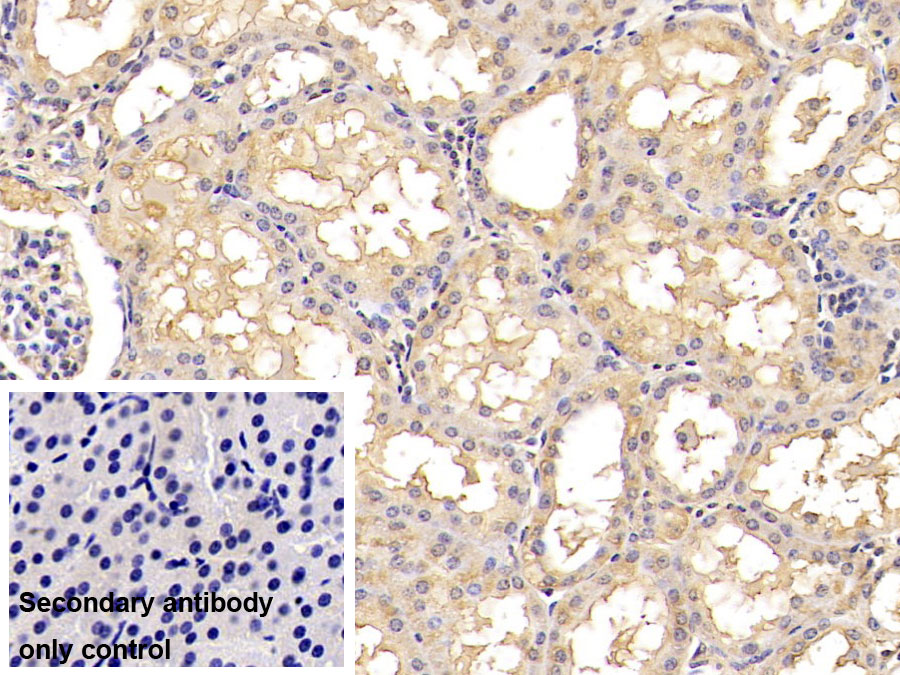 Monoclonal Antibody to Hypoxia Inducible Factor 1 Alpha (HIF1a)