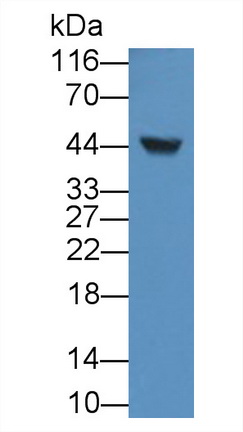 Monoclonal Antibody to Alpha-1-Acid Glycoprotein (a1AGP)