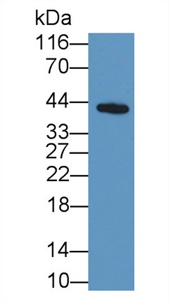 Monoclonal Antibody to Alpha-1-Acid Glycoprotein (a1AGP)