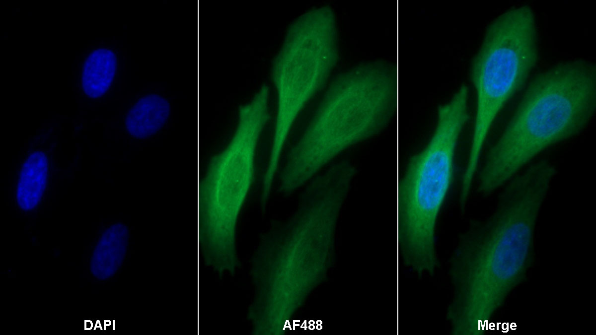 Monoclonal Antibody to Alpha-1-Acid Glycoprotein (a1AGP)