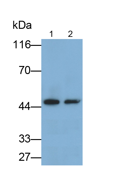 Monoclonal Antibody to Alpha-1-Acid Glycoprotein (a1AGP)