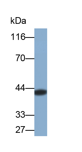 Monoclonal Antibody to Alpha-1-Acid Glycoprotein (a1AGP)