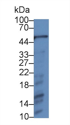 Monoclonal Antibody to Alpha-1-Acid Glycoprotein (a1AGP)