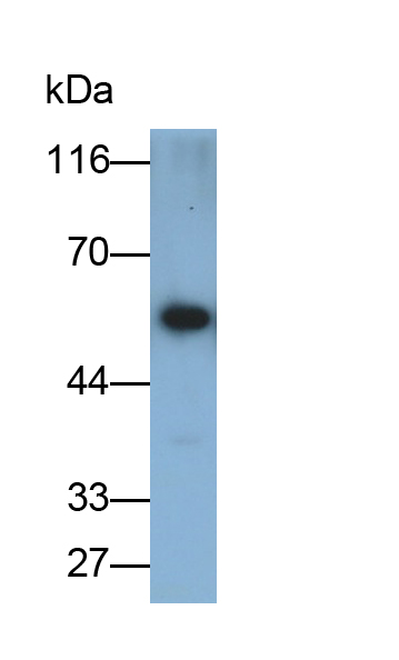 Monoclonal Antibody to Alpha-1-Acid Glycoprotein (a1AGP)