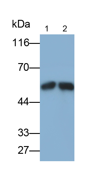 Monoclonal Antibody to Alpha-1-Acid Glycoprotein (a1AGP)