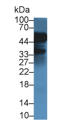 Monoclonal Antibody to Alpha-1-Acid Glycoprotein (a1AGP)