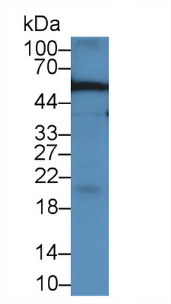 Monoclonal Antibody to Alpha-1-Acid Glycoprotein (a1AGP)