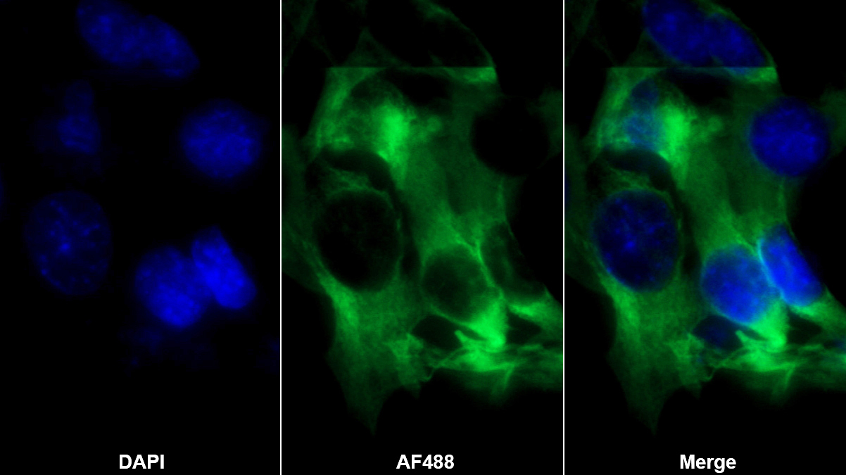 Monoclonal Antibody to Alpha-1-Acid Glycoprotein (a1AGP)