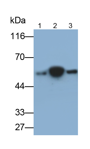 Monoclonal Antibody to Alpha-1-Acid Glycoprotein (a1AGP)