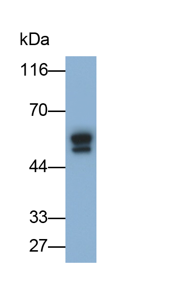 Monoclonal Antibody to Alpha-1-Acid Glycoprotein (a1AGP)