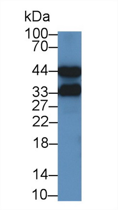 Monoclonal Antibody to Alpha-1-Acid Glycoprotein (a1AGP)