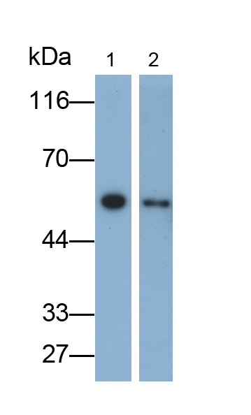 Monoclonal Antibody to Alpha-1-Acid Glycoprotein (a1AGP)