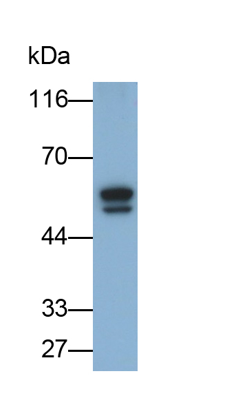 Monoclonal Antibody to Alpha-1-Acid Glycoprotein (a1AGP)