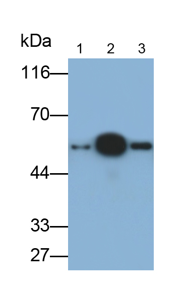 Monoclonal Antibody to Alpha-1-Acid Glycoprotein (a1AGP)