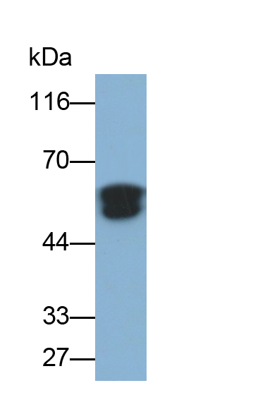 Monoclonal Antibody to Alpha-1-Acid Glycoprotein (a1AGP)