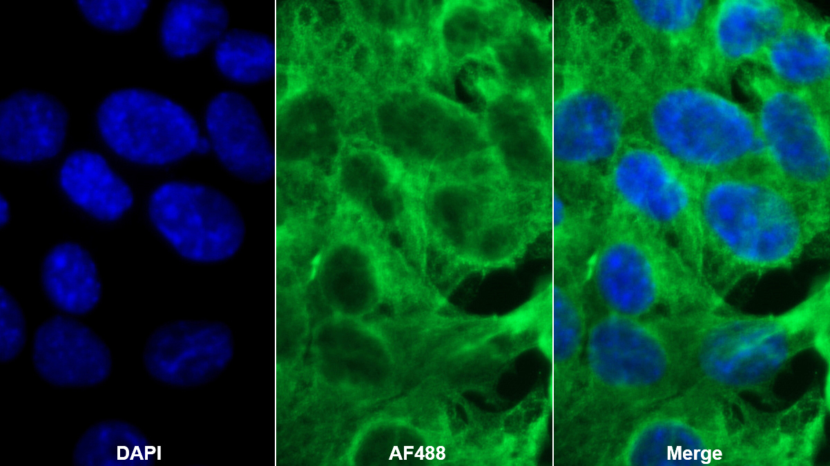 Monoclonal Antibody to Alpha-1-Acid Glycoprotein (a1AGP)