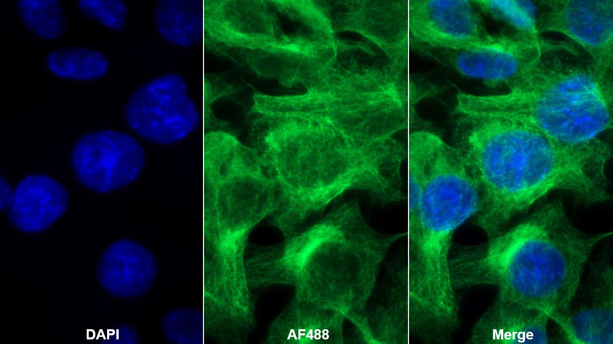 Monoclonal Antibody to Alpha-1-Acid Glycoprotein (a1AGP)