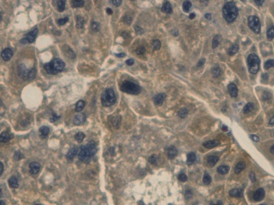 Monoclonal Antibody to Haptoglobin (Hpt)