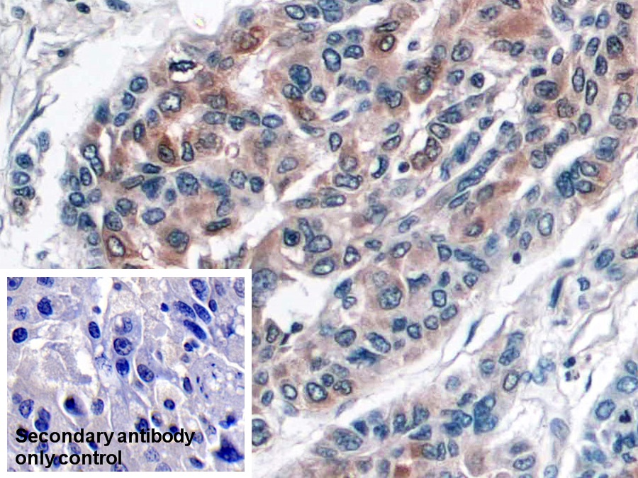 Monoclonal Antibody to Haptoglobin (Hpt)