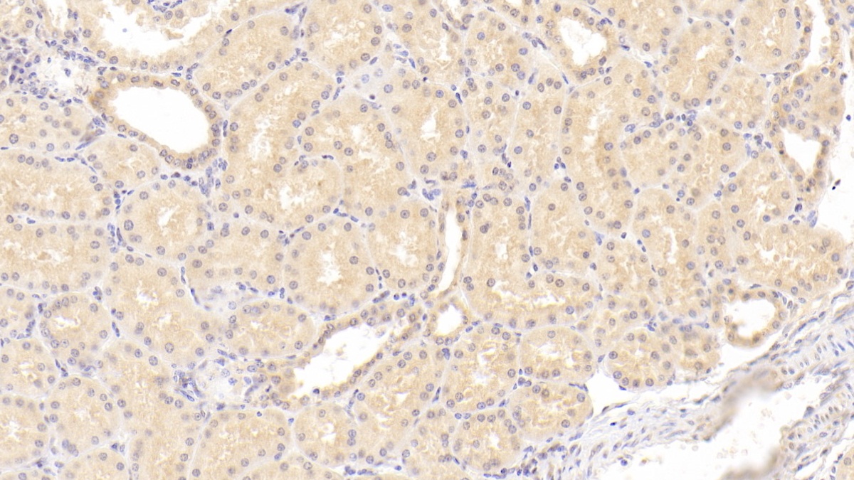 Monoclonal Antibody to Coagulation Factor II (F2)