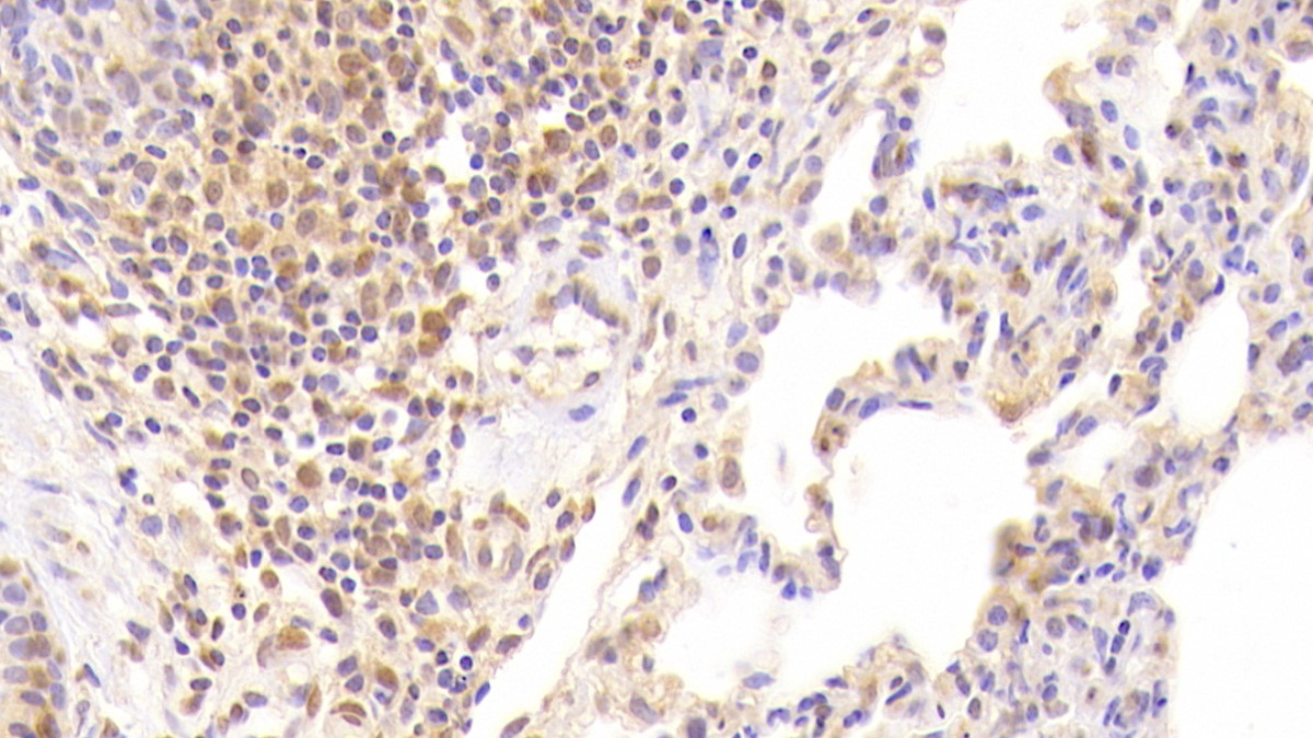 Monoclonal Antibody to Coagulation Factor II (F2)