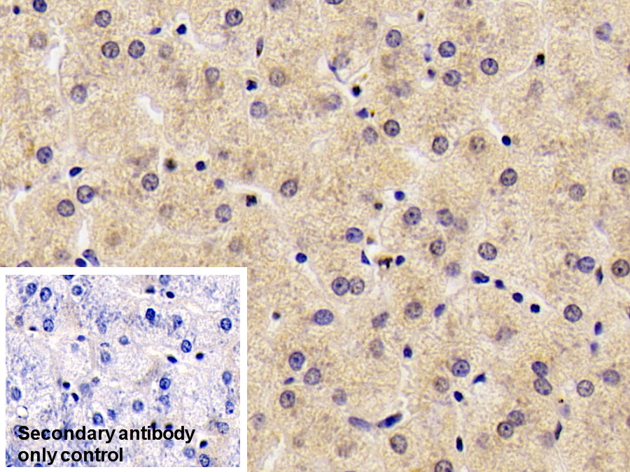 Monoclonal Antibody to Coagulation Factor II (F2)