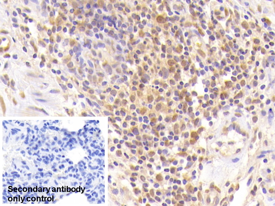 Monoclonal Antibody to Coagulation Factor II (F2)