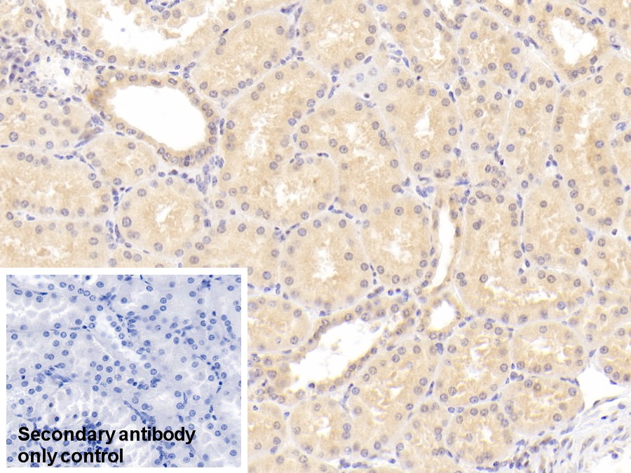 Monoclonal Antibody to Coagulation Factor II (F2)