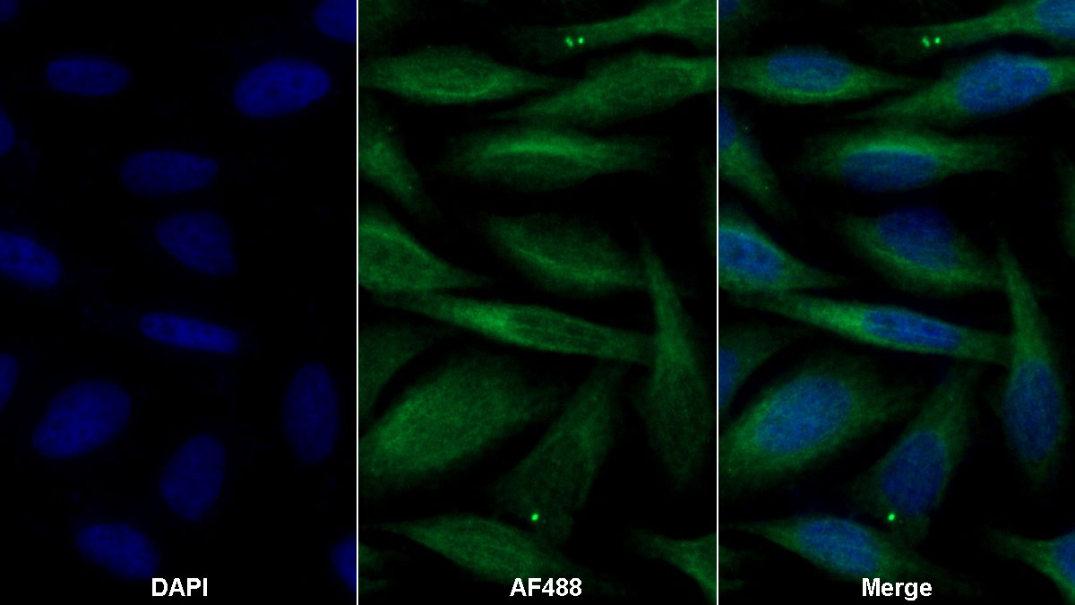 Monoclonal Antibody to Coagulation Factor II (F2)