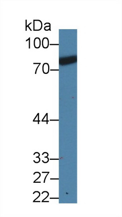 Monoclonal Antibody to Coagulation Factor II (F2)