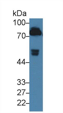 Monoclonal Antibody to Coagulation Factor II (F2)