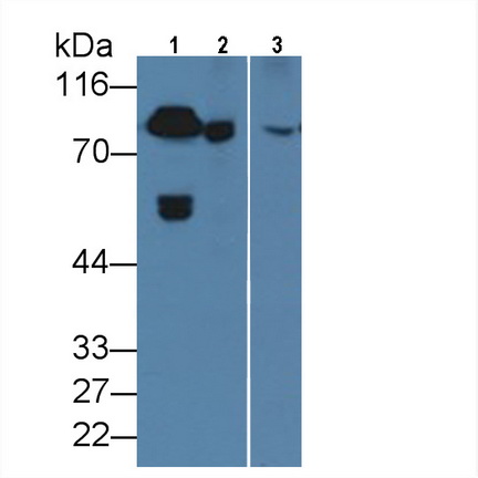 Monoclonal Antibody to Coagulation Factor II (F2)