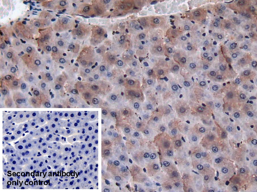 Monoclonal Antibody to Coagulation Factor II (F2)