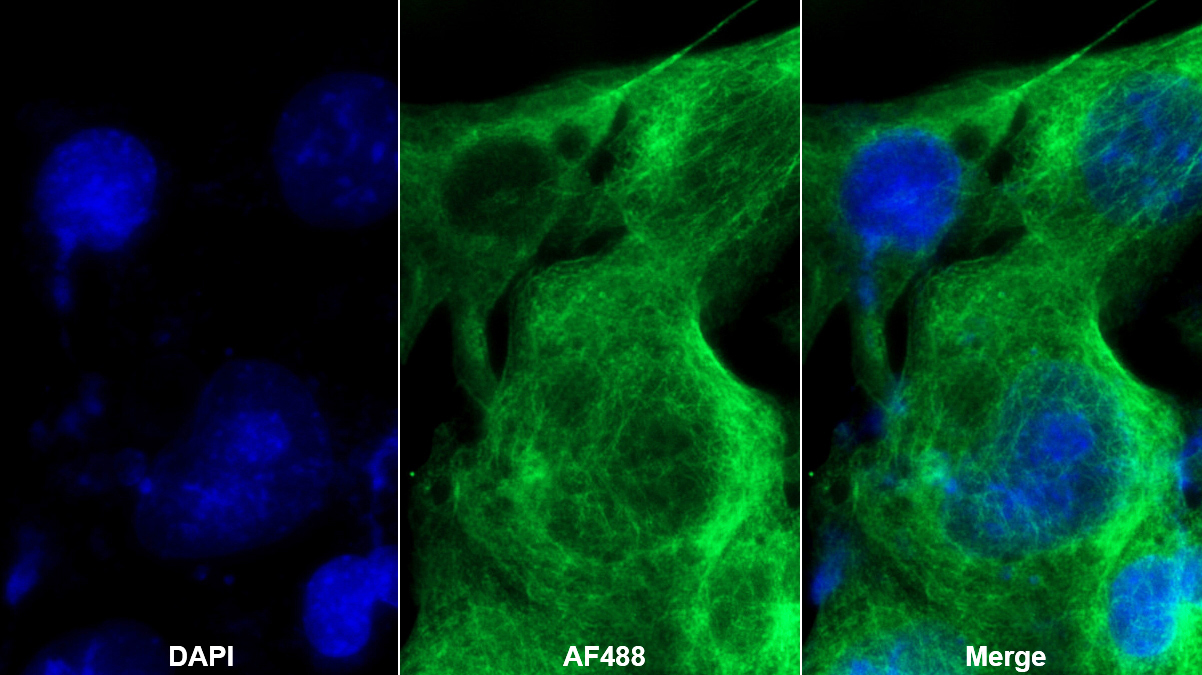 Monoclonal Antibody to Coagulation Factor II (F2)