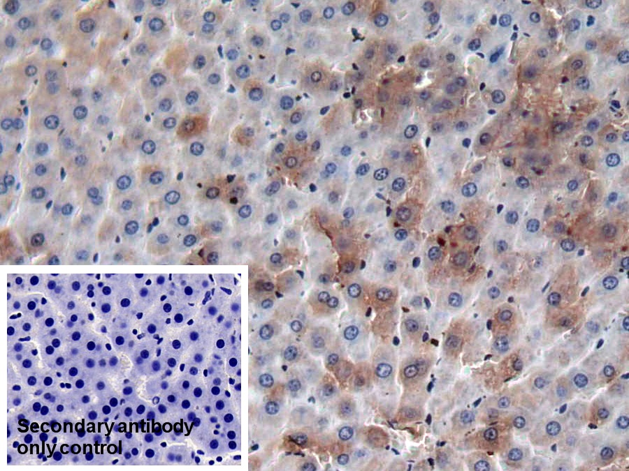 Monoclonal Antibody to Coagulation Factor II (F2)