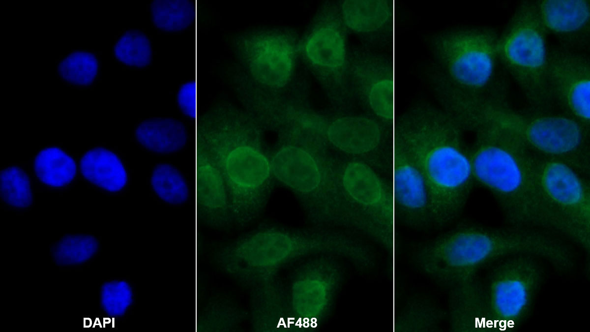 Monoclonal Antibody to C Reactive Protein (CRP)